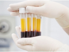 Đào tạo nghề spa khóa học làm trẻ hóa da PRP cấp tốc 