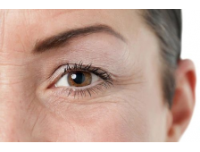 Địa chỉ xóa nhăn mắt bằng công nghệ plasma quận 12 TPHCM