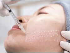 Tiêm Meso có tốt không? Nên tiêm bao lâu một lần?