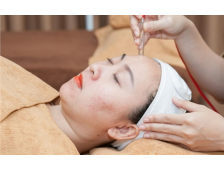 Top 5 Các Phương Pháp Điều Trị Mụn Hiệu Quả Tại Spa Được Ưa Chuộng Nhất Hiện Nay