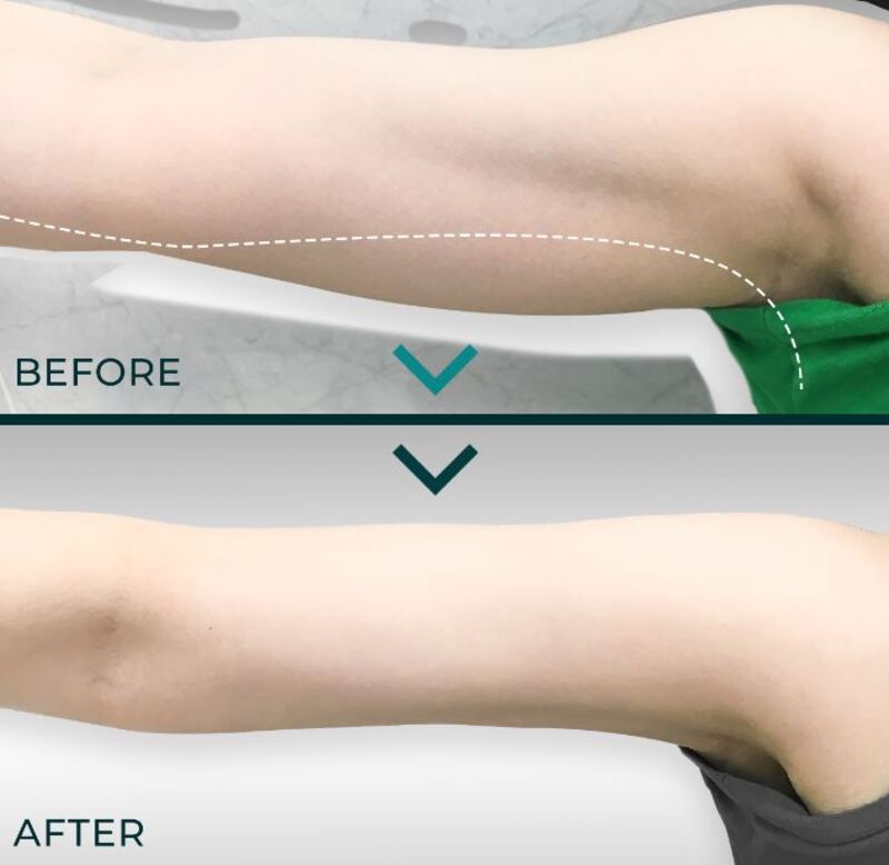 dao-thai-mo-thua-bap-tay-2