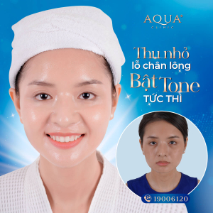 Lăn Kim Điều Trị Bệnh L&yacute;