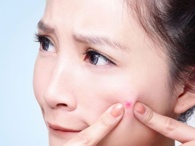 Chăm S&oacute;c Da Tuổi Teen Bị Mụn - B&iacute; Quyết Từ Chuy&ecirc;n Gia Thẩm Mỹ Viện H&agrave;ng Đầu