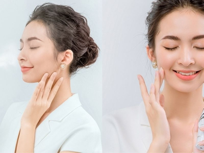 Trẻ h&oacute;a da PRP Kit trị sẹo rỗ, sẹo l&otilde;m c&oacute; an to&agrave;n v&agrave; hiệu quả kh&ocirc;ng?