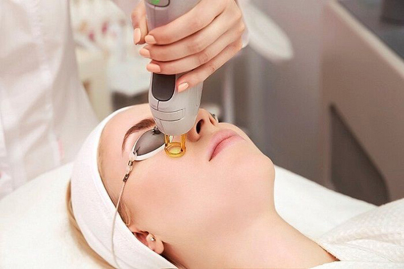Bắn tia Laser trẻ hóa da