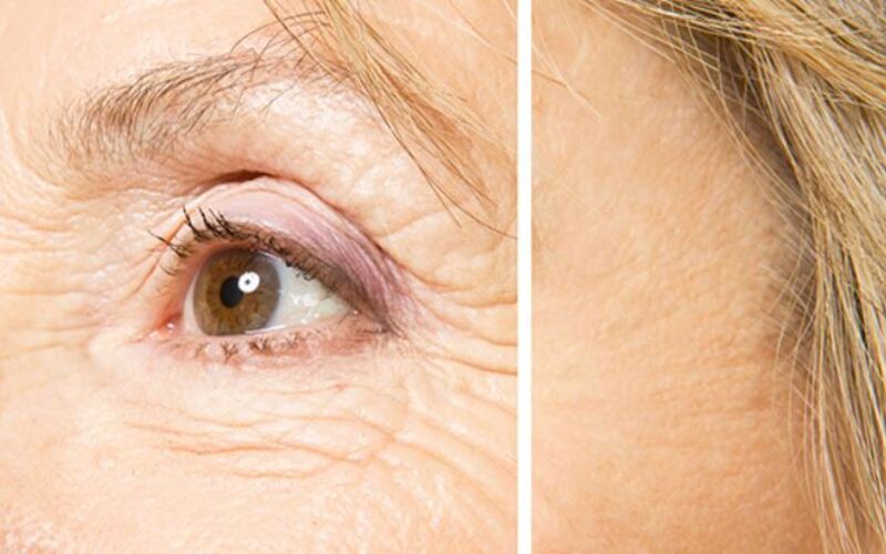 Làm trẻ hóa da mặt 