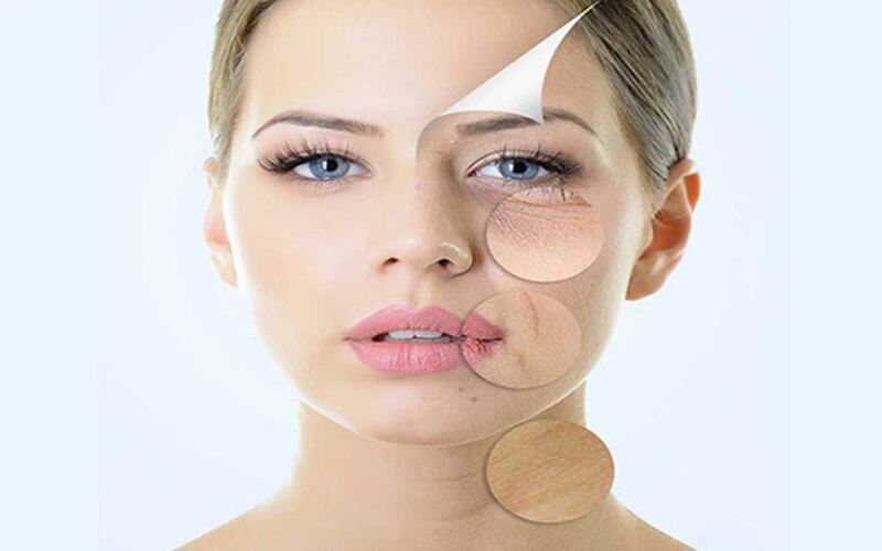 Trẻ hóa da bằng tế bào gốc tự thân 