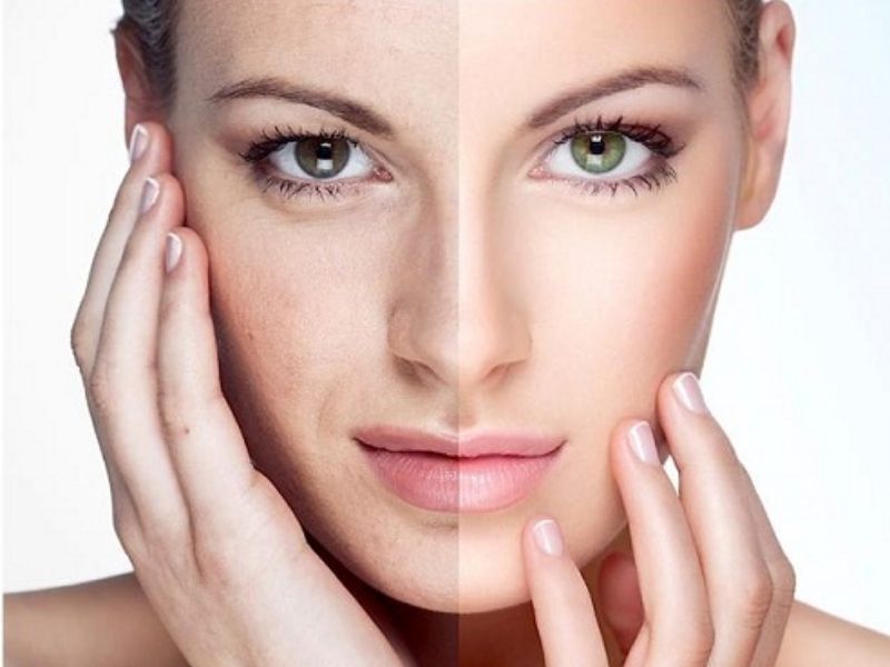 tre-hoa-da-prp-dung-duoc-bao-lau-1