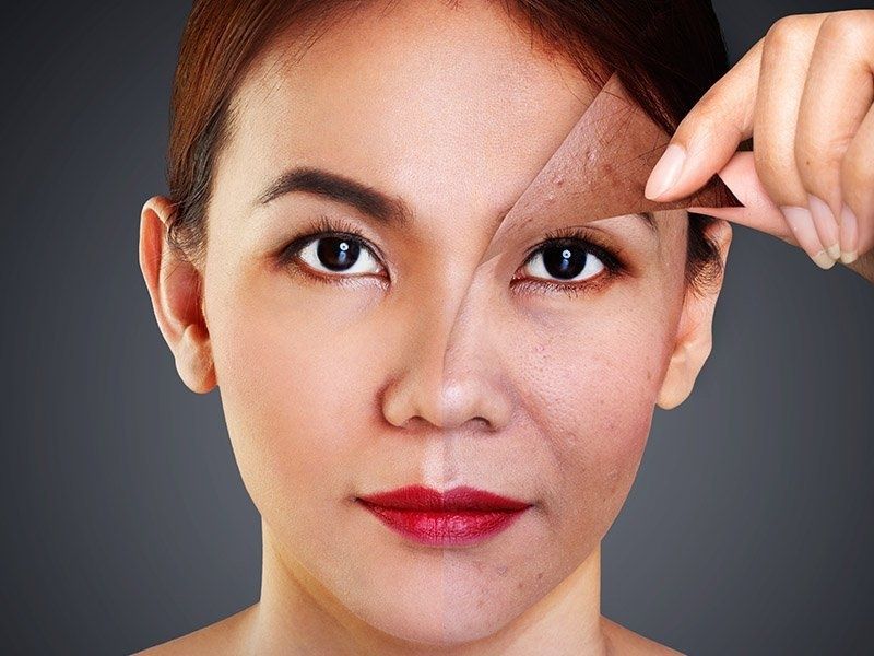 tre-hoa-da-prp-khuon-mat-1