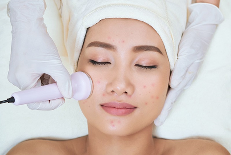 trang-sang-da-voi-vitamin-c-1